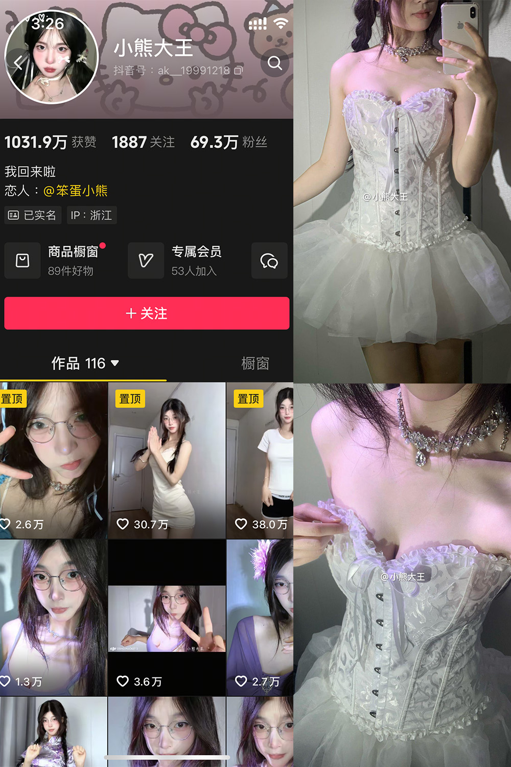 抖音 小熊大王 微密圈 001期 【32P】-欲兔